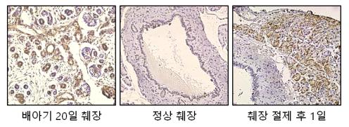 그림> 배아기, 정상, 90% 절제 후 췌장에서 Pref-1의 발현