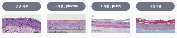 정상 피부, B 제품(EpiDerm), C 제품(EpiSkin), 대상기술
