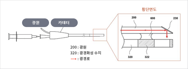 광원, 카테터, 횡단면도 / 200 : 광원, 320 : 광경화성 수지, → : 광경로