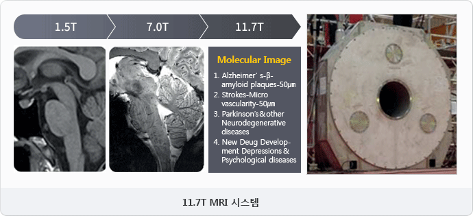 11.7T MRI 시스템