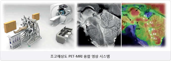 초고해상도 PET-MRI 융합 영상 시스템